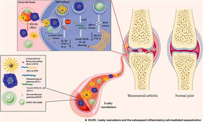 Nanomaterials Manipulate Macrophages for Rheumatoid Arthritis Treatment